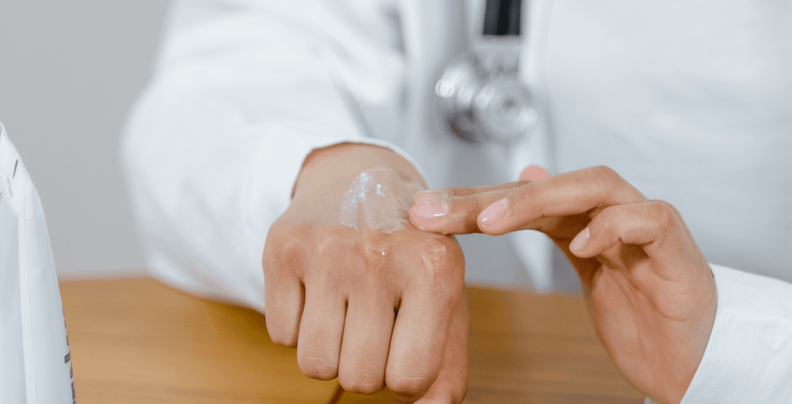 Eczema