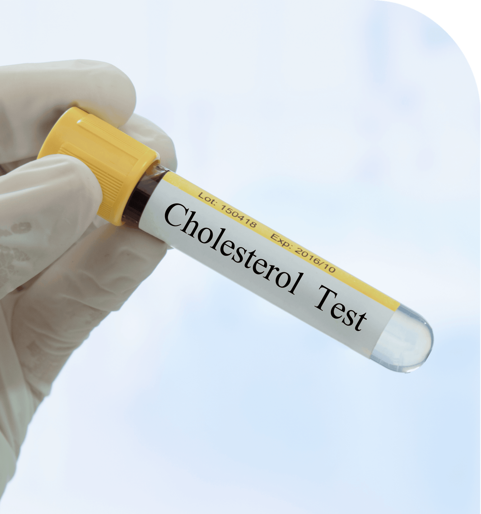 High cholesterol (1)