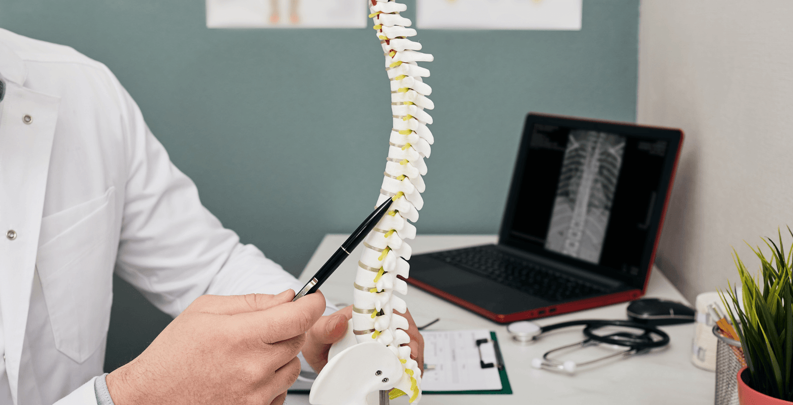 Osteoporosis (1)